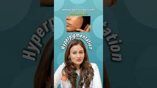 Can One Treatment Fix Your Hyperpigmentation?  #drgeetikamittalgupta #isaacluxe #hyperpigmentation