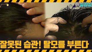 [지식실험] 잘못된 습관으로 탈모 생길 수 있습니다  [위기탈출 넘버원] | KBS 20070818 방송