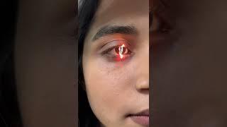 Slit Lamp examination.