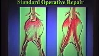 Dolan Lecture Series 2002 - Barry T. Katzen, MD