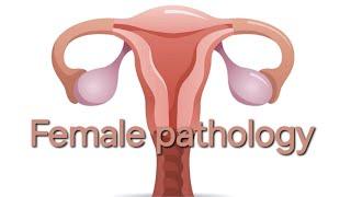 Female pathology 5th lecture.