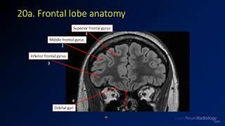 Neuroradiology review - brain gyral anatomy