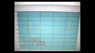 4) dB Meter Readings - Rivergate (VIEW 34)  ~ HELIPORT ~ NYUCD; CO Poisoning; Uninhabitable, PART 4