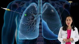 Diagnosing Lung Cancer by early identification of pulmonary nodules.