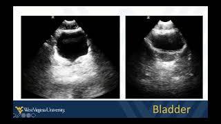 Abdominal POCUS 5 - Renal