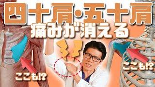 【四十肩・五十肩】肩の痛みを消す方法【Frozen shoulder】