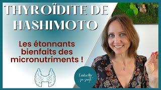 Hypothyroïdie d’Hashimoto, régime alimentaire et solutions naturelles