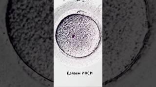 Оплодотворение методом ИКСИ#бесплодие #дети #зачатие #женское