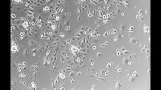 Time lapse of skin cells, known as keratinocytes, growing in the lab