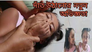 দাঁত উঠানোর নতুন অভিজ্ঞতা।A new teething experience