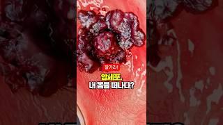 의사들도 놀란 항암 음식 TOP 3 공개!