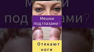 Отекают ноги? Смотри описание