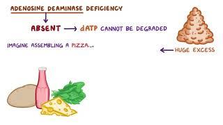 Immunology: Adenosine deaminase deficiency