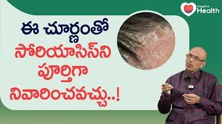 Psoriasis | ఈ చూర్ణంతో సోరియాసిస్‌ని పూర్తిగా నివారించవచ్చు.. Dr. Ch Madhusudana Sarma | Tone Health