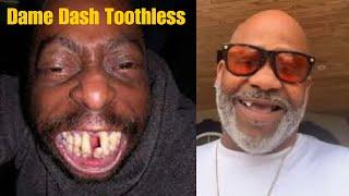 Dame Dash's Grillz Disaster: Watch As They Fall Out Live!