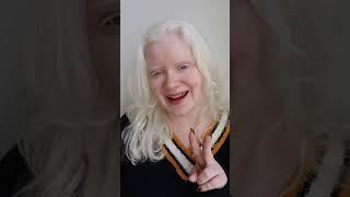 How do I Read Comments if I’m Blind? | 3 Ways I Read Comments on Social Media #shorts