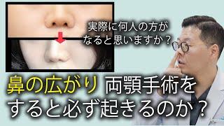 【韓国両顎】 両顎手術後の鼻の広がり？ どのくらい生じるのでしょうか？ ㅣワイ口腔顎顔面外科医院