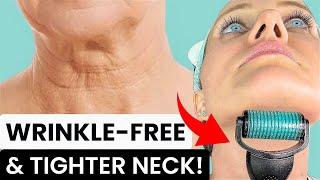 HOW TO GET A YOUNGER LOOKING NECK WITH 0.75MM DERMAROLLER - FIX NECK LINES, WRINKLES, SAGGY NECK