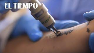 El arte de borrar tatuajes con láser | El Tiempo