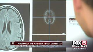 Finding a cure for Lewy body dementia