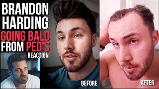 BRANDON HARDING IS CRUSHED HAIR IS FALLING OUT AT 25 Y/O *MY REACTION & ADVICE*