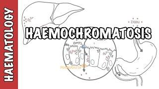 Haemochromatosis (Iron Overload) - iron physiology, causes and pathophysiology