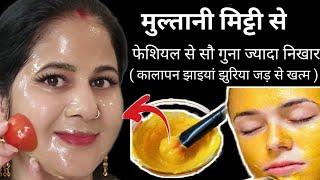 Multani Mitti देगी बेदाग गोरी त्वचा:Instant Skin Whitening with Multani Mitti