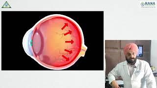 Glaucoma Awareness Week (Rana Hospital Ludhiana)