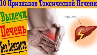 Как восстановить печень? Важные 10 признаков токсической печени!