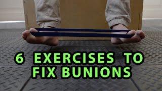 6 Exercises to Fix Bunions