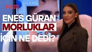 ENES GÜRAN KOLUNDAKİ İZLERE NE DEDİ