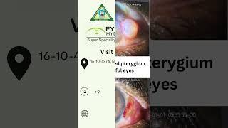 From advanced pterygium to beautiful eyes | Eye care Hyderabad