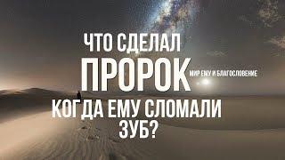 Что сделал Пророк ﷺ когда Ему сломали зуб?