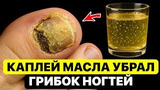 Дерматолог: капнул и грибок отходит вместе с салфеткой! А если МАСЛО СМЕШАТЬ с...