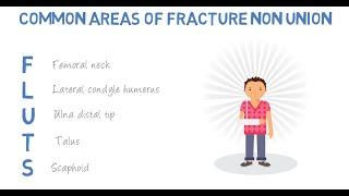 What are the common areas of fracture non union