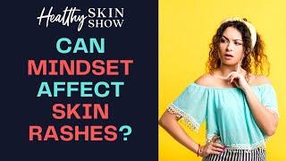 MINDSET And Skin Rashes | Jennifer Fugo