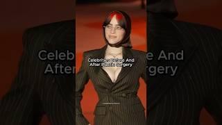 Plastic Surgery Transformations