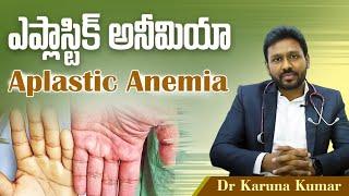 Aplastic Anemia | Bonemarrow Failure | Dr Karuna Kumar | Hematologist