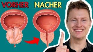 BECKENBODENTRAINING für MÄNNER : Die EINE PROSTATA-ÜBUNG, die ALLES verändert