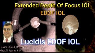 Extended Depth Of Focus IOL ( My First three Cases ) Lucidis IOL