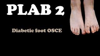 PLAB 2 station: Diabetic foot