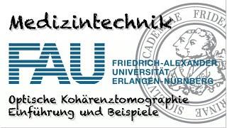 Medizintechnik - Optische Kohärenztomographie