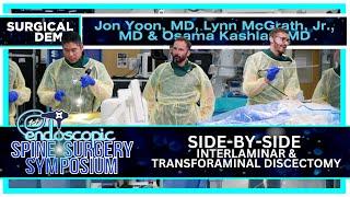 Side by Side : Interlaminar & Transforaminal Discectomy - Jon JW Yoon, MD & Lynn McGrath, MD