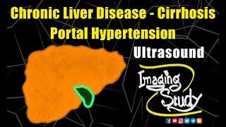 Chronic Liver Disease - Cirrhosis - Portal Hypertension - Portosystemic Collaterals || Imaging Study