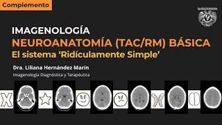 Neuroanatomía seccional básica (TAC y RM) - El sistema "ridículamente simple"