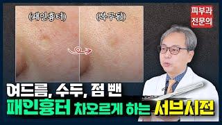 패인 흉터 레이저 치료했는데 효과 없다면? '서브시전' 시술의 모든 것 [ 여드름 흉터 치료 ]