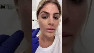 Would you try the non-surgical glow up by Dr. Simon Ourian?