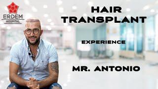 Erdem Hospital / Hair Transplant in Turkey / Our Patient Antonio