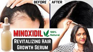 STOP Hairfall! Grow Hair at Rocket speed treat Baldness from 1st week | Minoxidil|Serum Men & Women