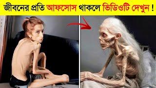 যেকোনো ঝড়েই উড়ে যাবে এই ১০ চিকন মেয়ে..!  || Top 10 Thinnest People In Bangla